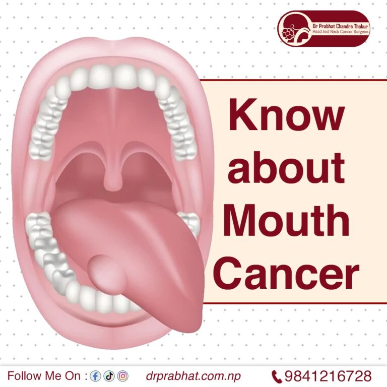 Know about mouth cancer