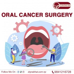 Oral cancer surgery