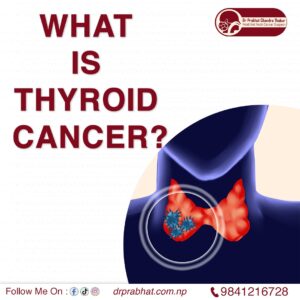 What is Thyroid Cancer