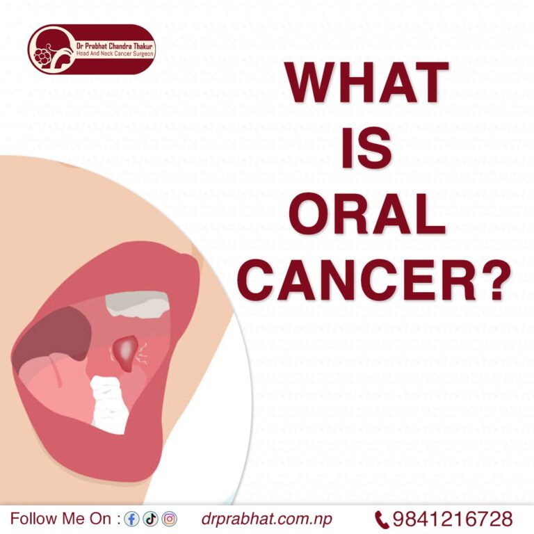 What is oral cancer