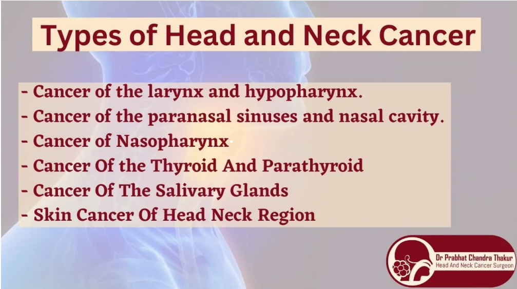 Types of head & neck cancer