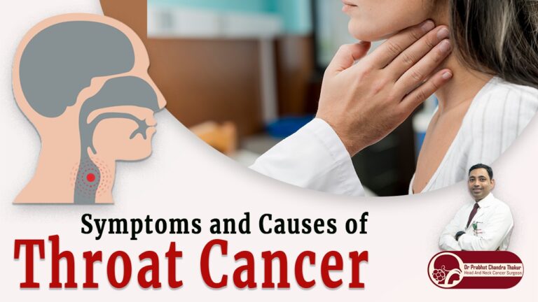 Symptoms and causes of throat cancer