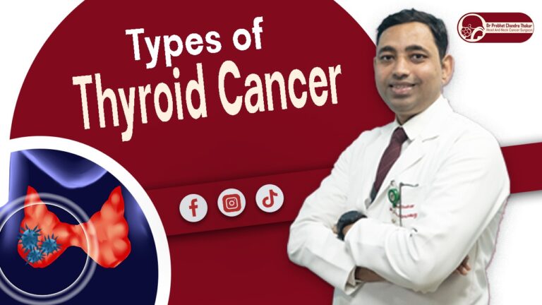 Types of Thyroid cancer