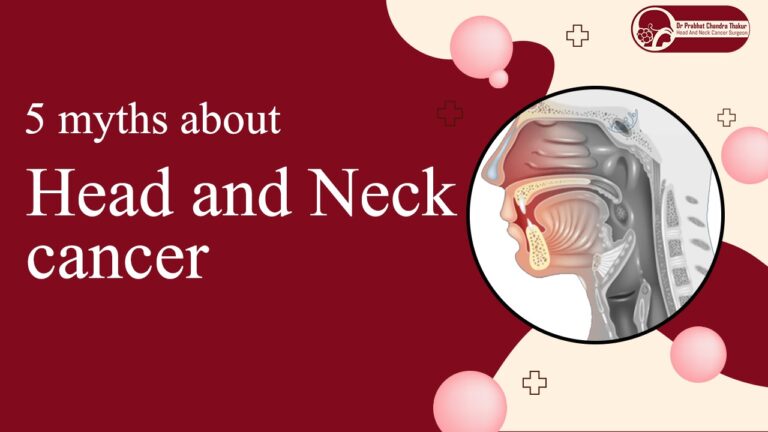 Myths about head and neck cancer
