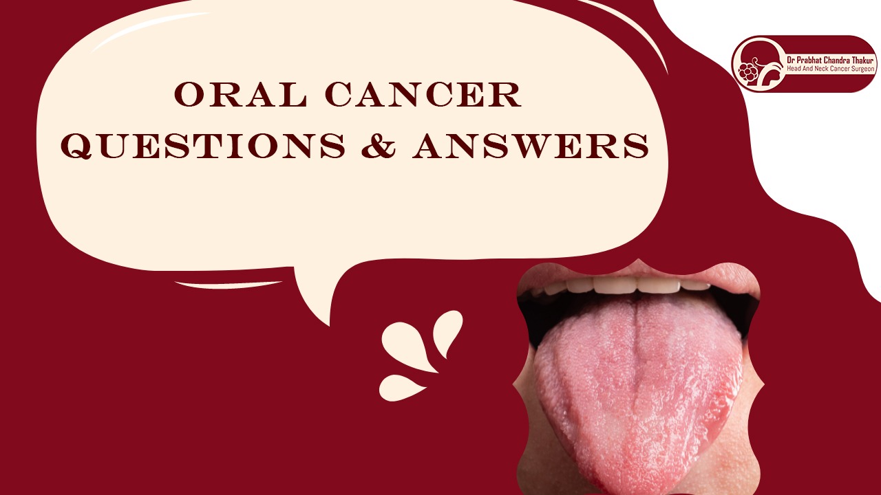 Oral Cancer Q&A
