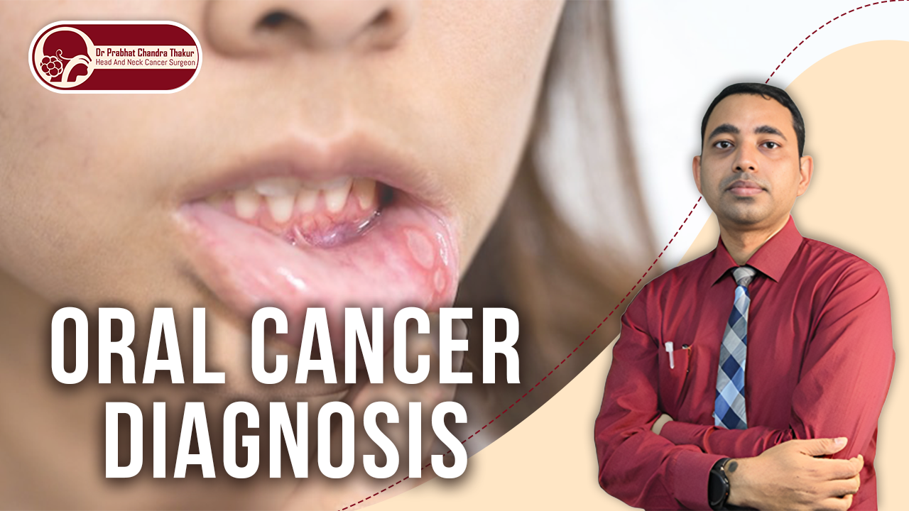 Oral cancer Diagnosis