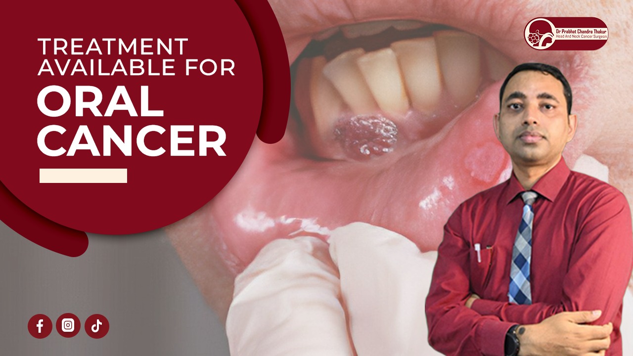 Treatment For Oral Cancer
