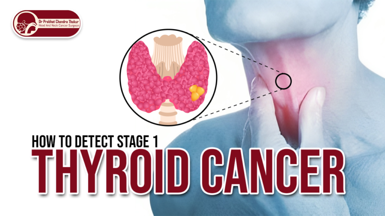Stage Thyroid Cancer