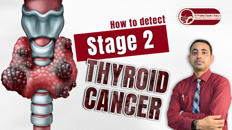 Stage 2 Thyroid Cancer
