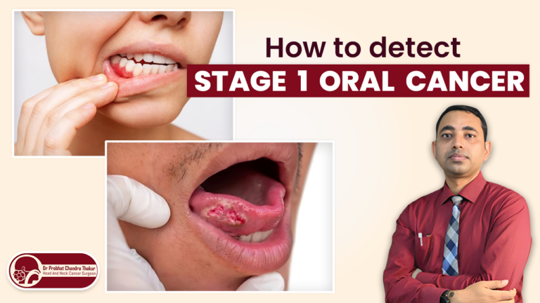 Detect Stage 1 Oral Cancer