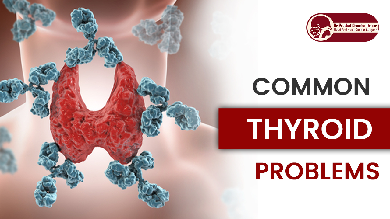 Common Thyroid Problems