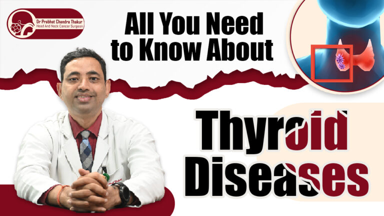 Thyroid Diseases