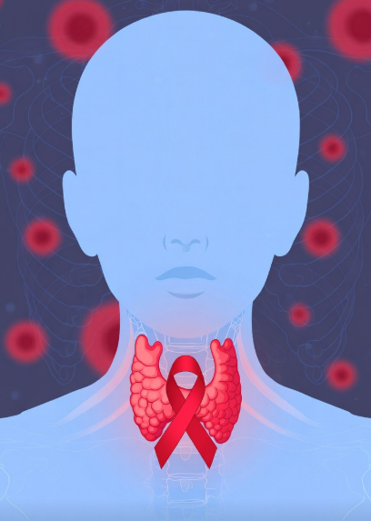 thyroid cancer surgeon in Nepal