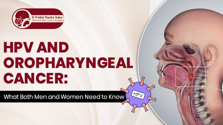 Oropharyngeal Cancer
